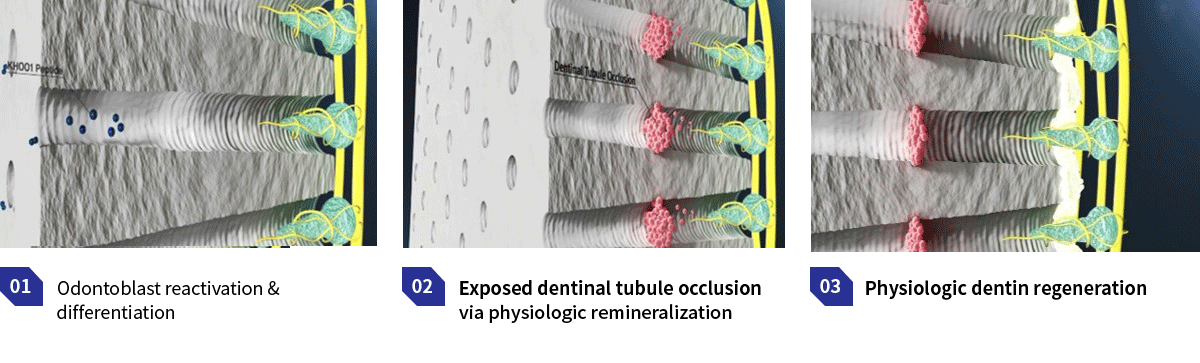 World’s First Native Dentin Regeneration
