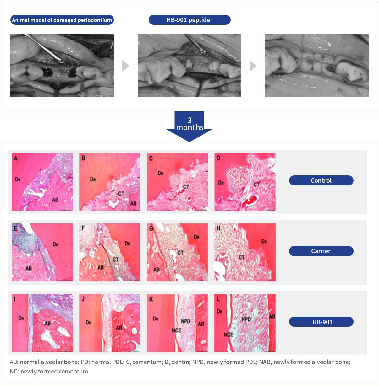 Confirmed periodontal tissue regenerative function of HB901 in nonclinical tooth replantation model