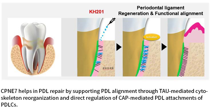 CPNE7 helps in PDL repair by supporting PDL alignment through TAU-mediated cytoskeleton reorganization and direct regulation of CAP-mediated PDL attachments of PDLCs.